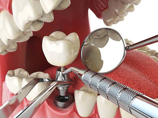 Best Emergency Treatment for Oral Infections in Shreve, OH